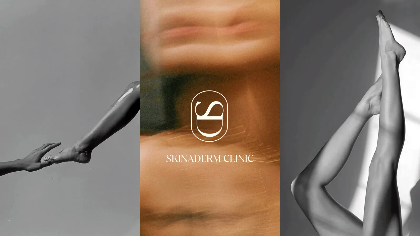 Skinaderm Clinic