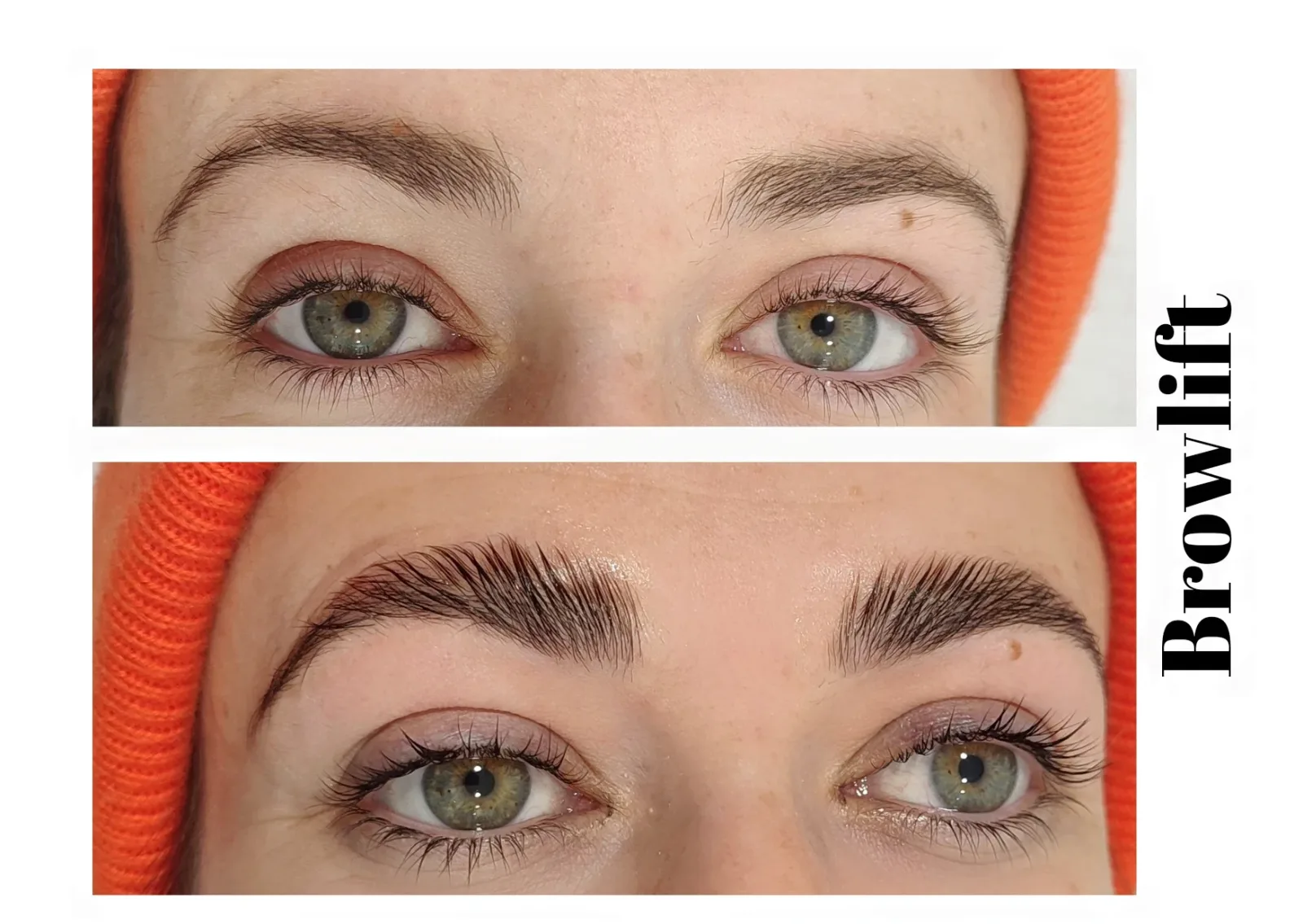 Ô bulles du bien-être - Laser & Soins Esthétiques - Institut de beauté La Penne-sur-Huveaune - Ô bulles du bien-être - Laser & Soins Esthétiques - Photo Galerie - OneBooking