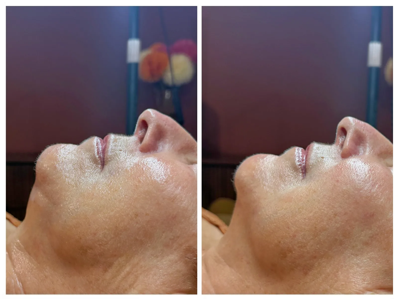 Cabinet Sentè • Soin du visage | Radiofréquence | INDIBA | Minceur | Hydrafacial - Onglerie Donville-les-Bains - Cabinet Sentè • Soin du visage | Radiofréquence | INDIBA | Minceur | Hydrafacial - Photo Galerie - OneBooking