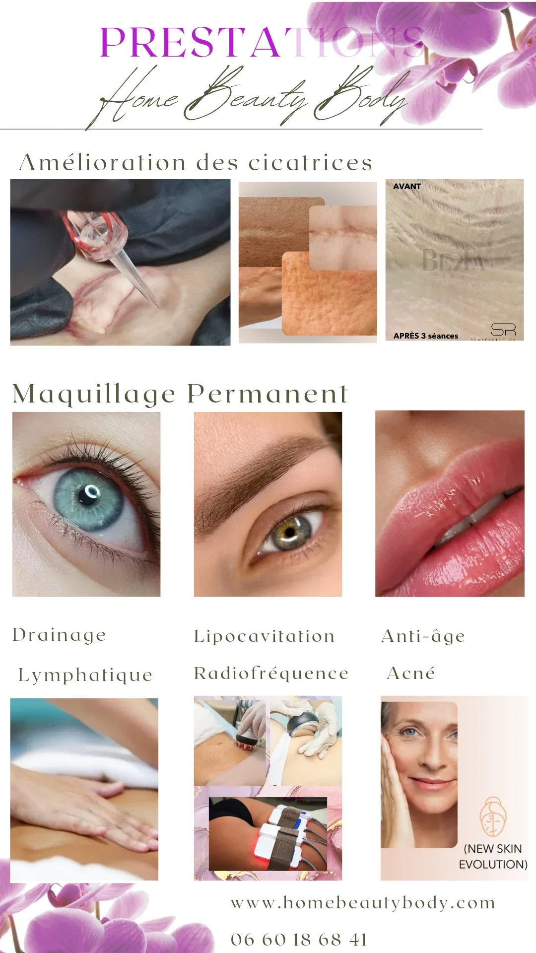 Home beauty body - dermopigmentation correctrice, traitement des cicatrices - Institut de beauté Gisors - Home beauty body - dermopigmentation correctrice, traitement des cicatrices - Photo Galerie - OneBooking
