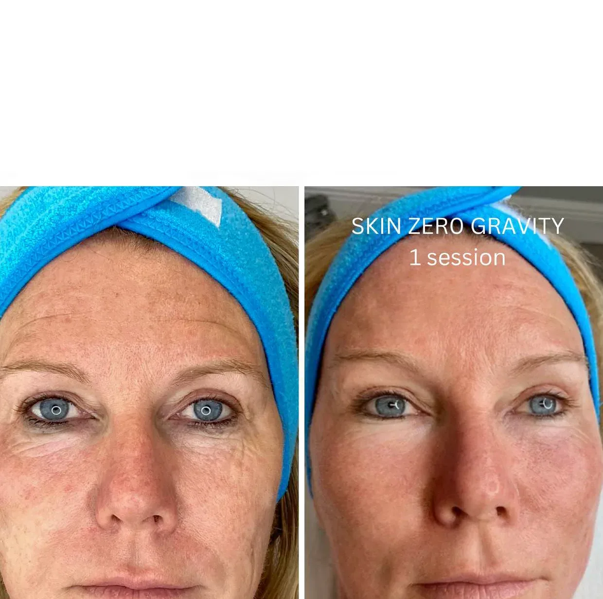 Aura Derme - Institut de beauté Draguignan - Aura Derme - Photo Galerie - OneBooking
