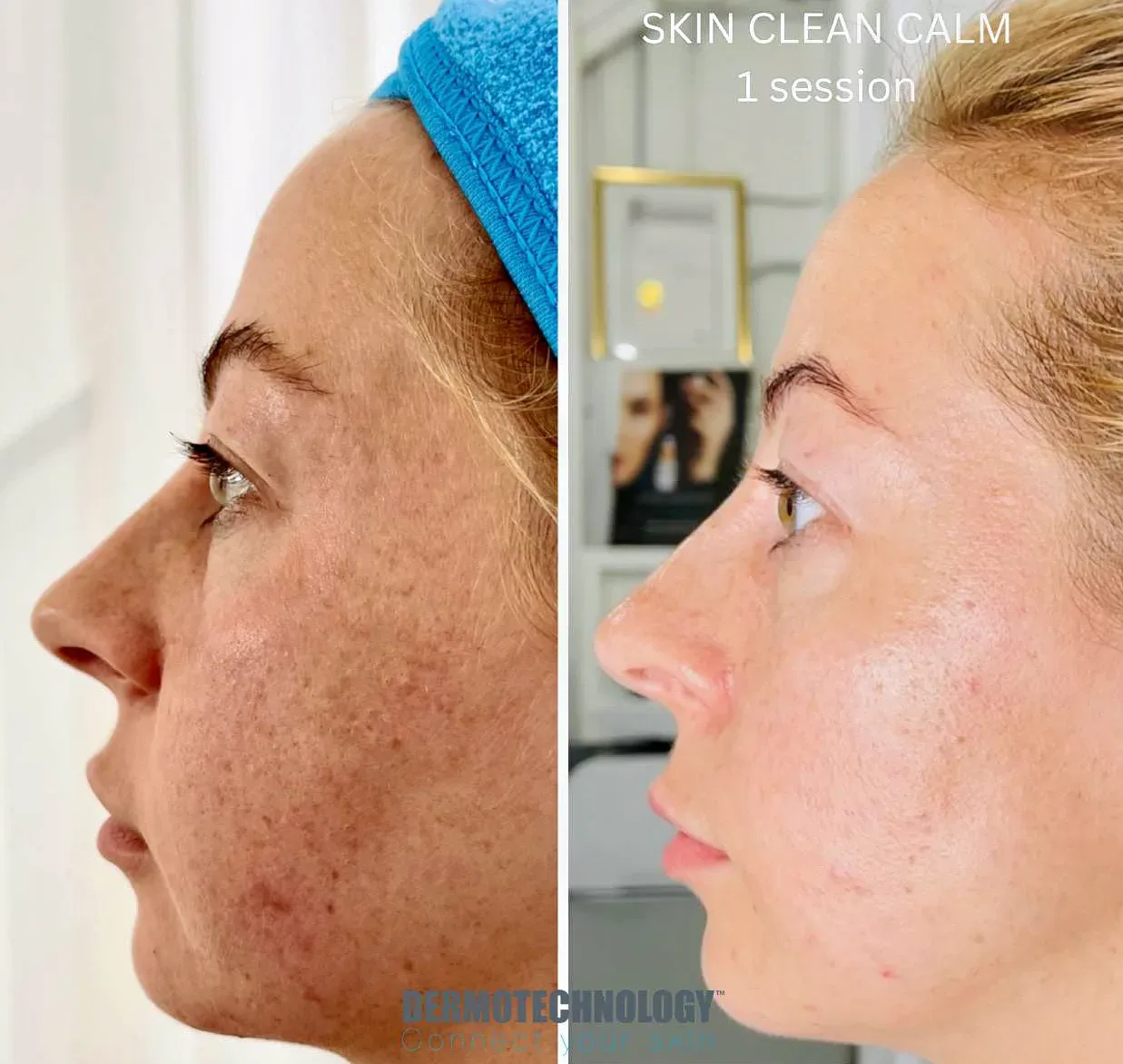 Aura Derme - Institut de beauté Draguignan - Aura Derme - Photo Galerie - OneBooking