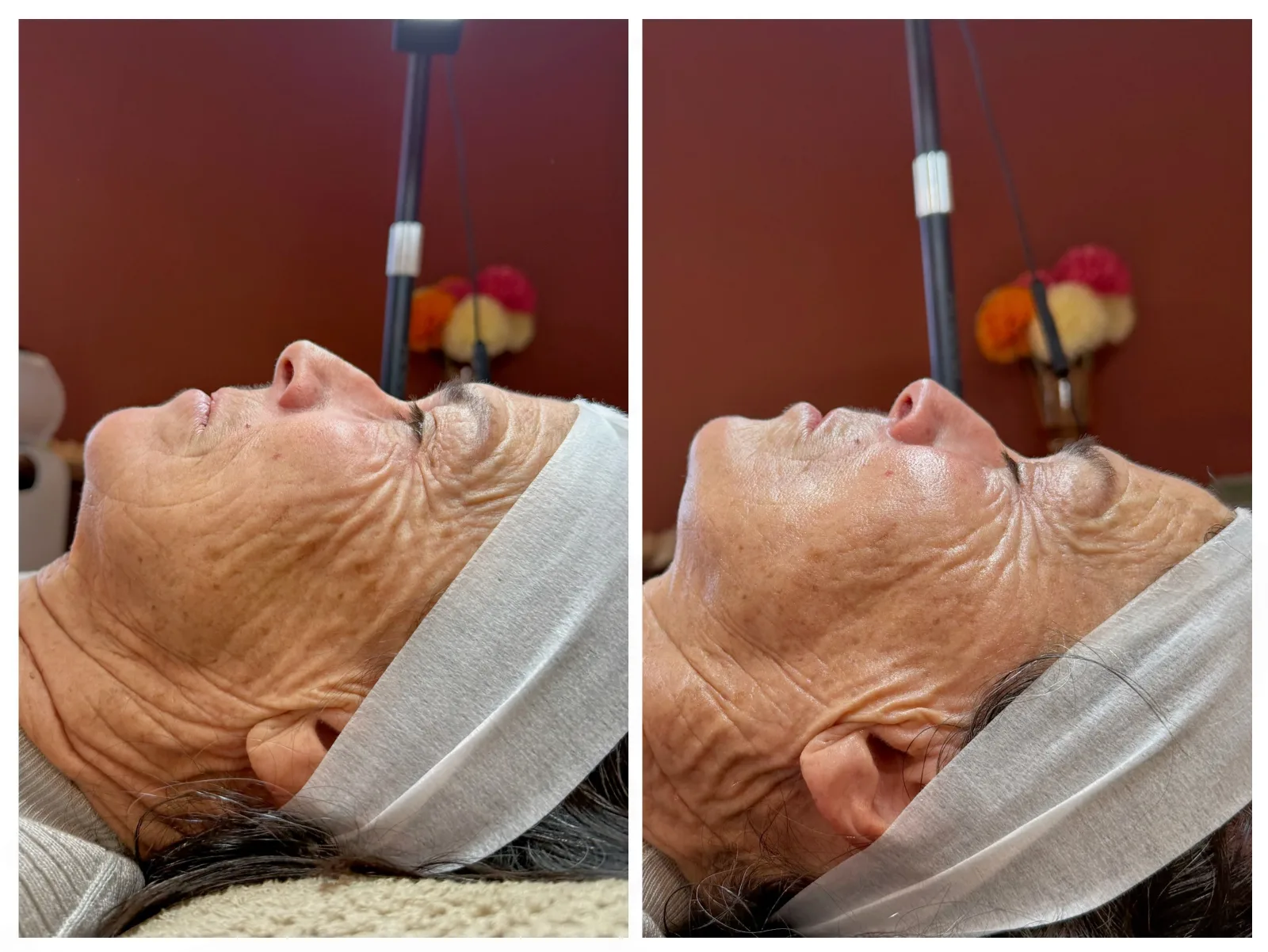 Cabinet Sentè • Soin du visage | Radiofréquence | INDIBA | Minceur | Hydrafacial - Onglerie Donville-les-Bains - Cabinet Sentè • Soin du visage | Radiofréquence | INDIBA | Minceur | Hydrafacial - Photo Galerie - OneBooking