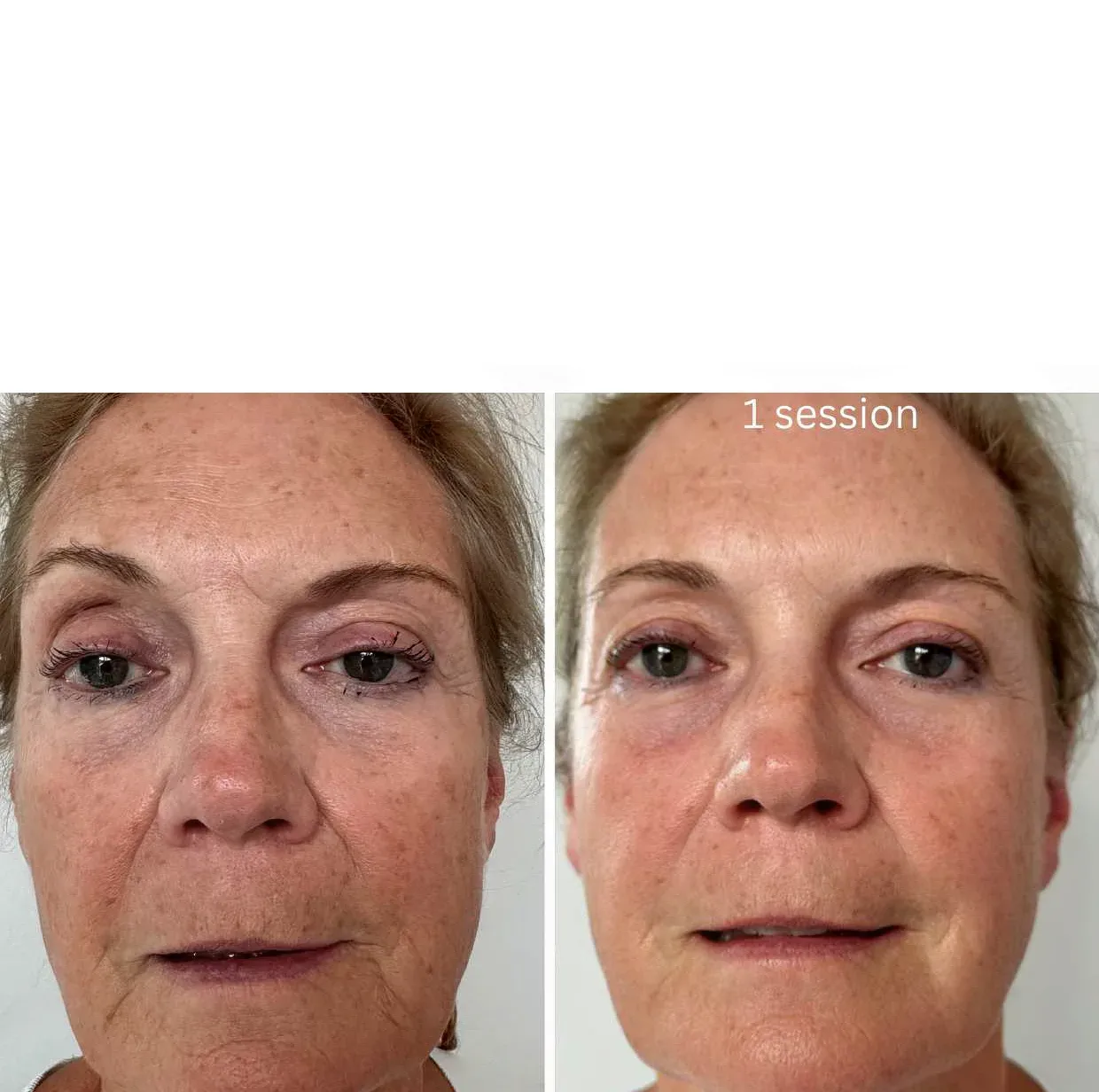 Aura Derme - Institut de beauté Draguignan - Aura Derme - Photo Galerie - OneBooking