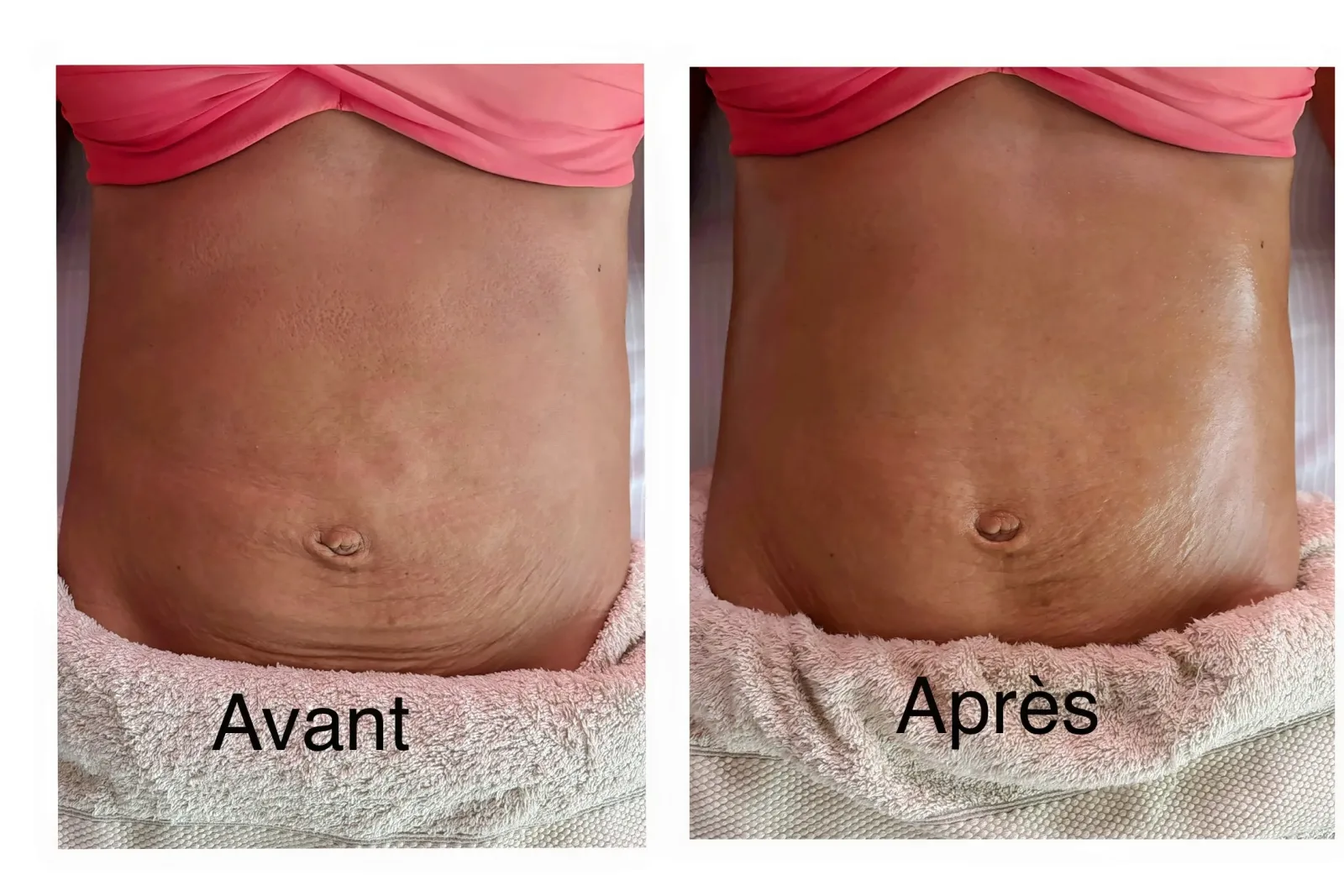 Aliz & Aur - Massage Saint-Denis - Aliz & Aur - Photo Galerie - OneBooking