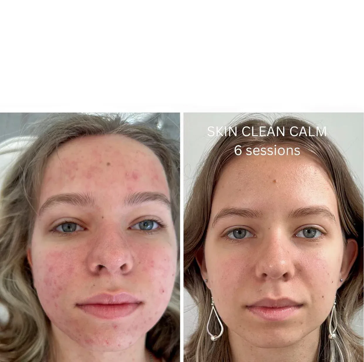 Aura Derme - Institut de beauté Draguignan - Aura Derme - Photo Galerie - OneBooking