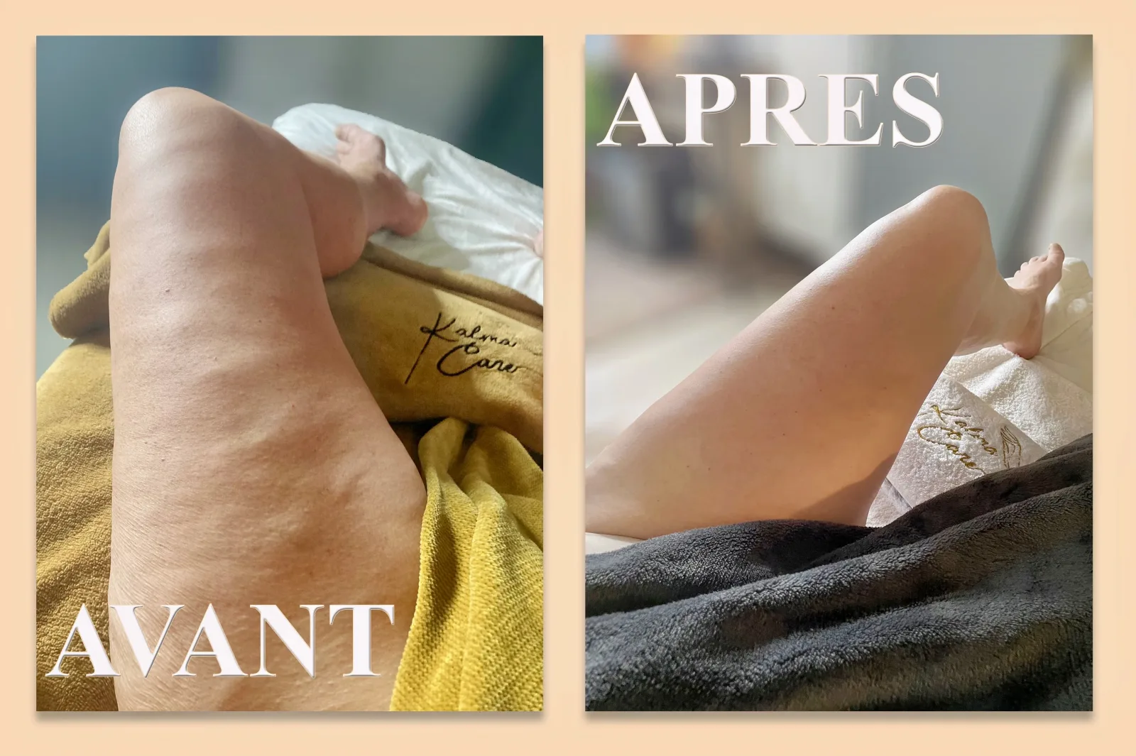 Kalma.Care - Onglerie Toulouse - Kalma.Care - Photo Galerie - OneBooking