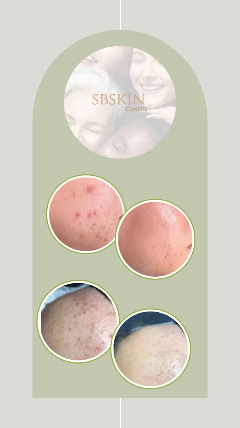 SBskin