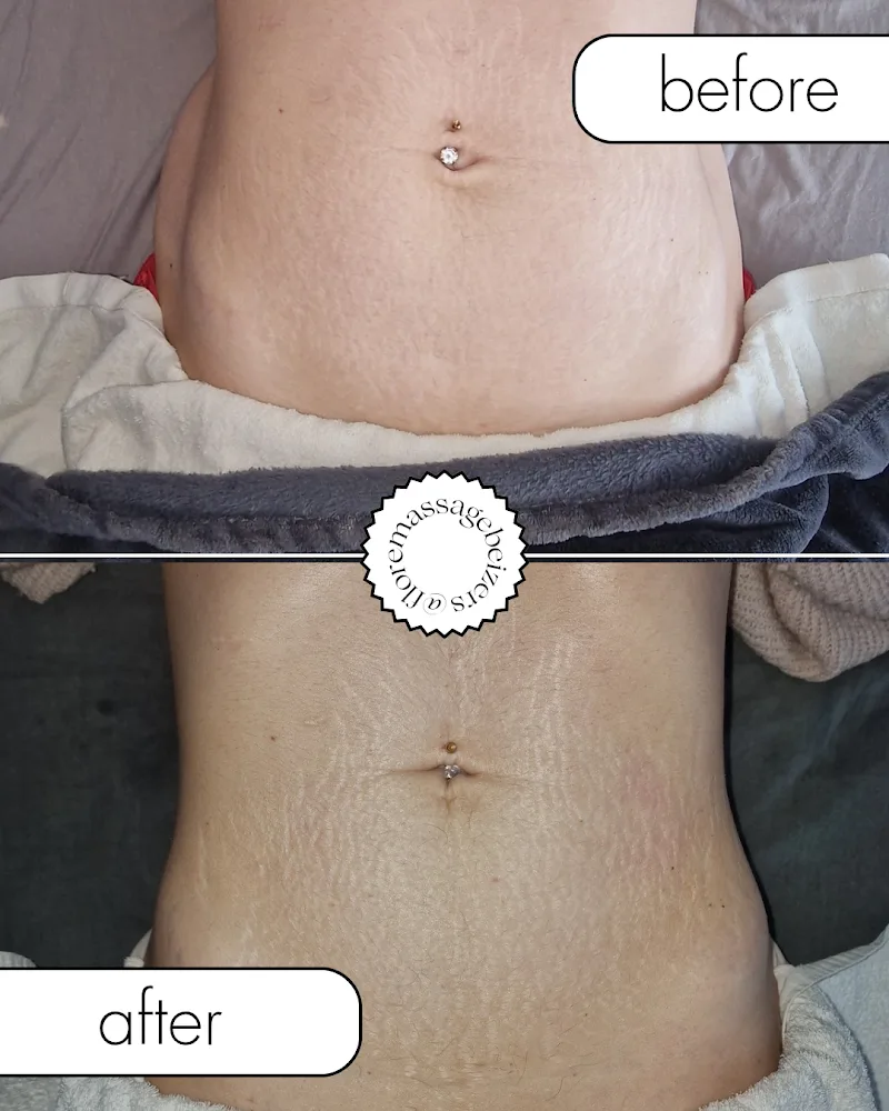 Flore massage, drainage lymphatique et maderotherapie - Bien-être Béziers - Photo de couverture - OneBooking