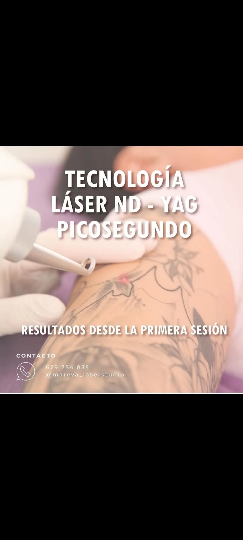 Mareva Láser Studio
