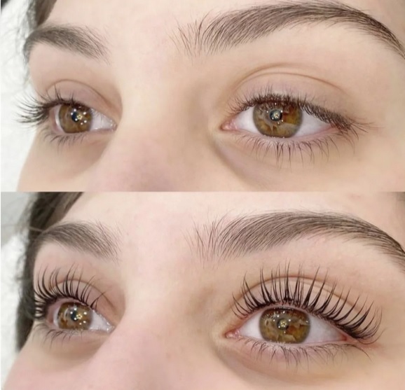 NATURAL BEAUTY VALENCIA Estética & Depilación Láser SHR