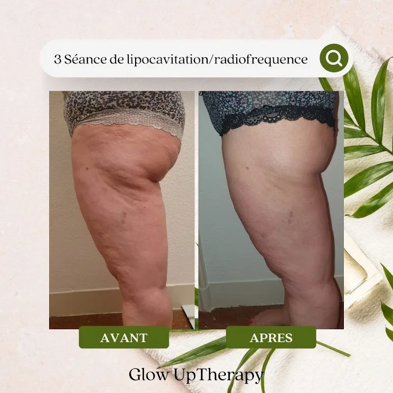 Glow UpTherapy