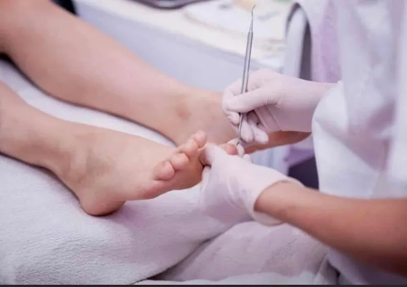 Pédicure Médical