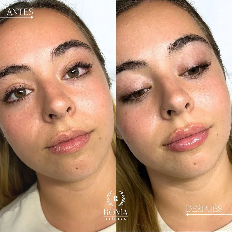 Clínica Roma - Medicina Estética Málaga - Esthétique Málaga - Photo de couverture - OneBooking